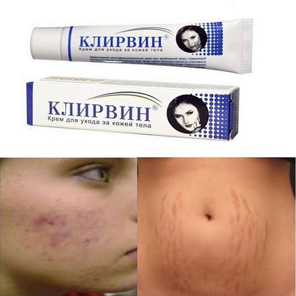 Klirvin kremi çapis izlerine son